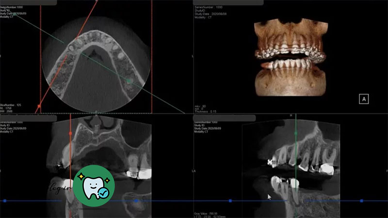 اسکن سفالومتریک و سی تی اسکن با پرتو مخروطی (CBCT)