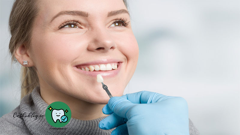 مرتب کردن دندان بدون ارتودنسی با لمینت دندان (Veneers)